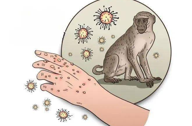 事关猴痘，世卫组织发布最高级别警报！湖南疾控回应来了