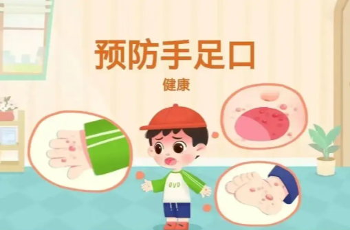 中国疾控中心：手足口病重症比例显著下降