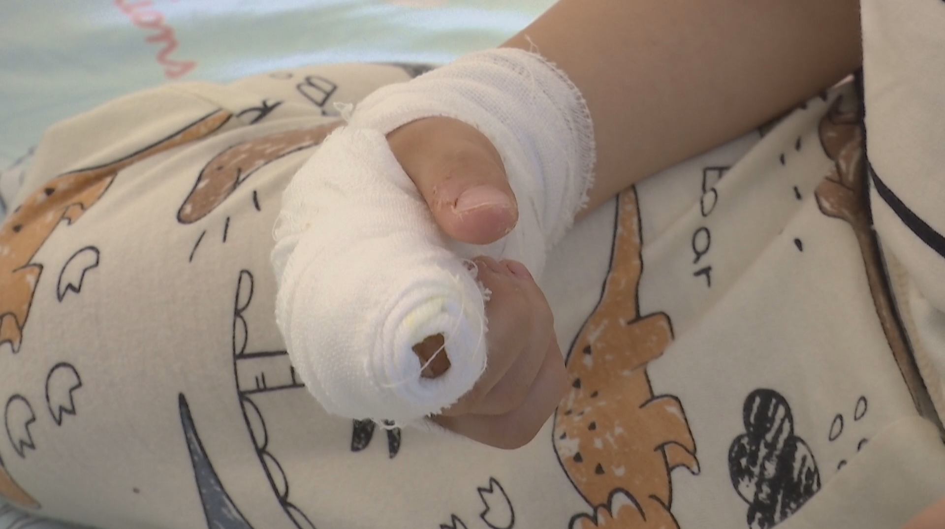 小习惯藏大危险 儿童手指感染案例敲响警钟